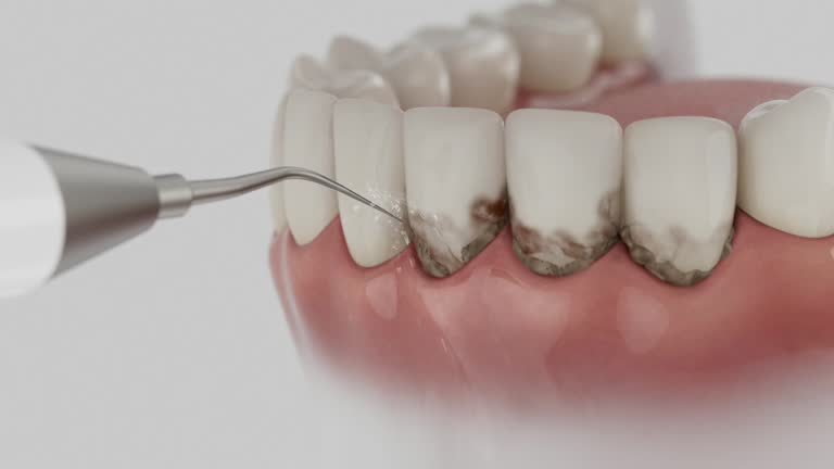 Trusted Teeth Cleaning And Checkup service in Andrews, TX - Dentist Open Now